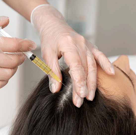Hair PRP Therapy & GFC Treatment