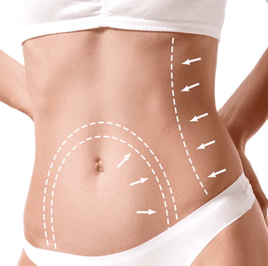 Body Contouring