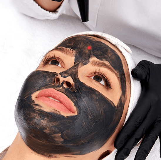 Hollywood Carbon Peel